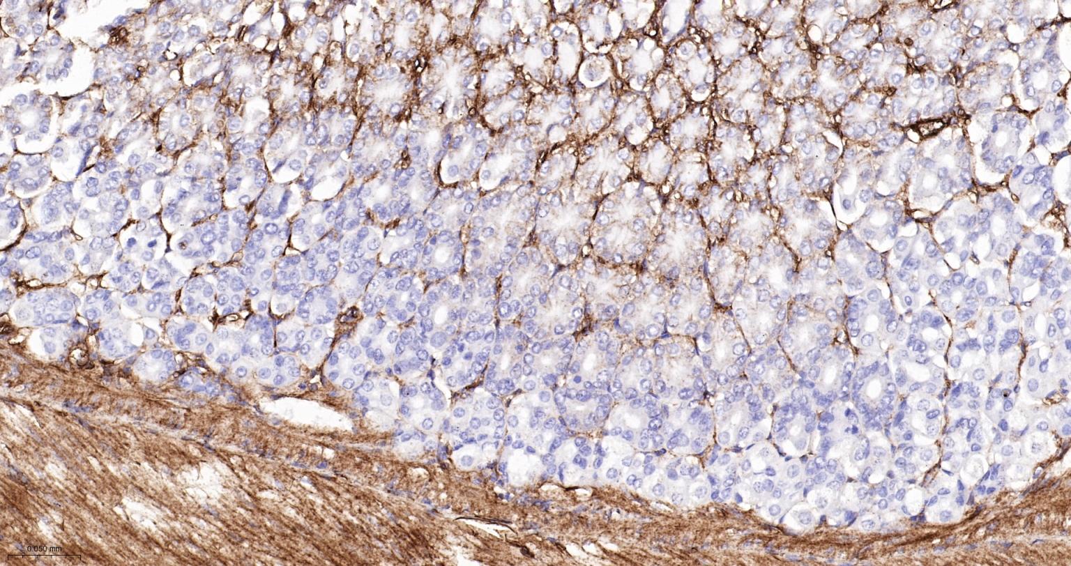 粘着斑蛋白（内参）重组兔单抗