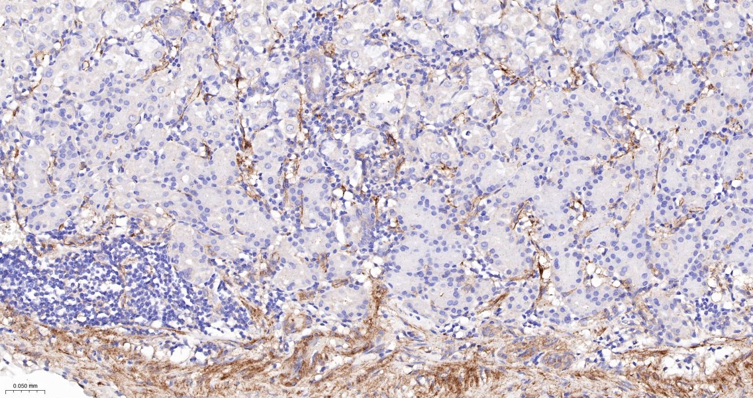 粘着斑蛋白（内参）重组兔单抗