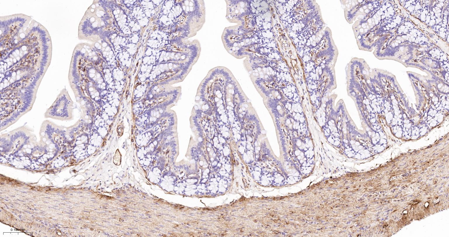 粘着斑蛋白（内参）重组兔单抗