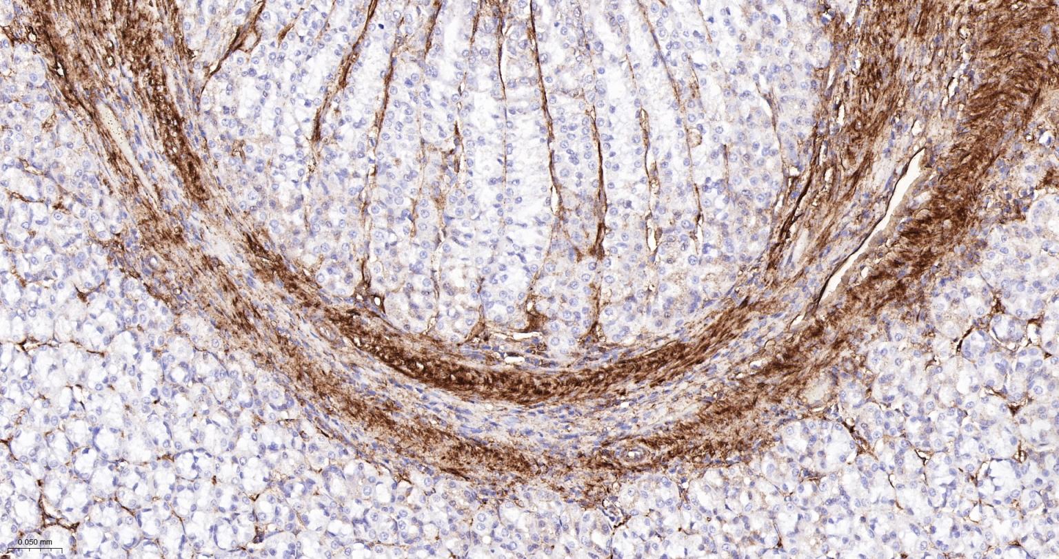 粘着斑蛋白（内参）重组兔单抗
