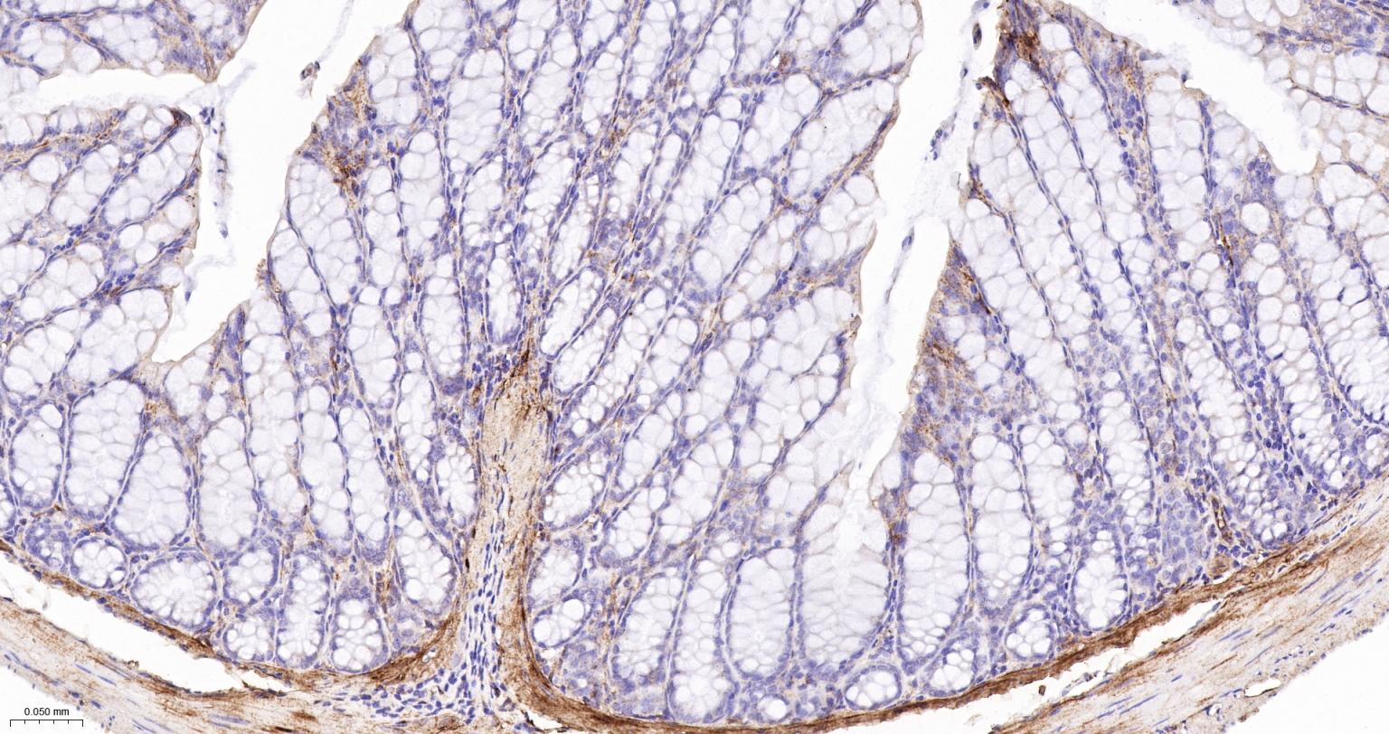 粘着斑蛋白（内参）重组兔单抗