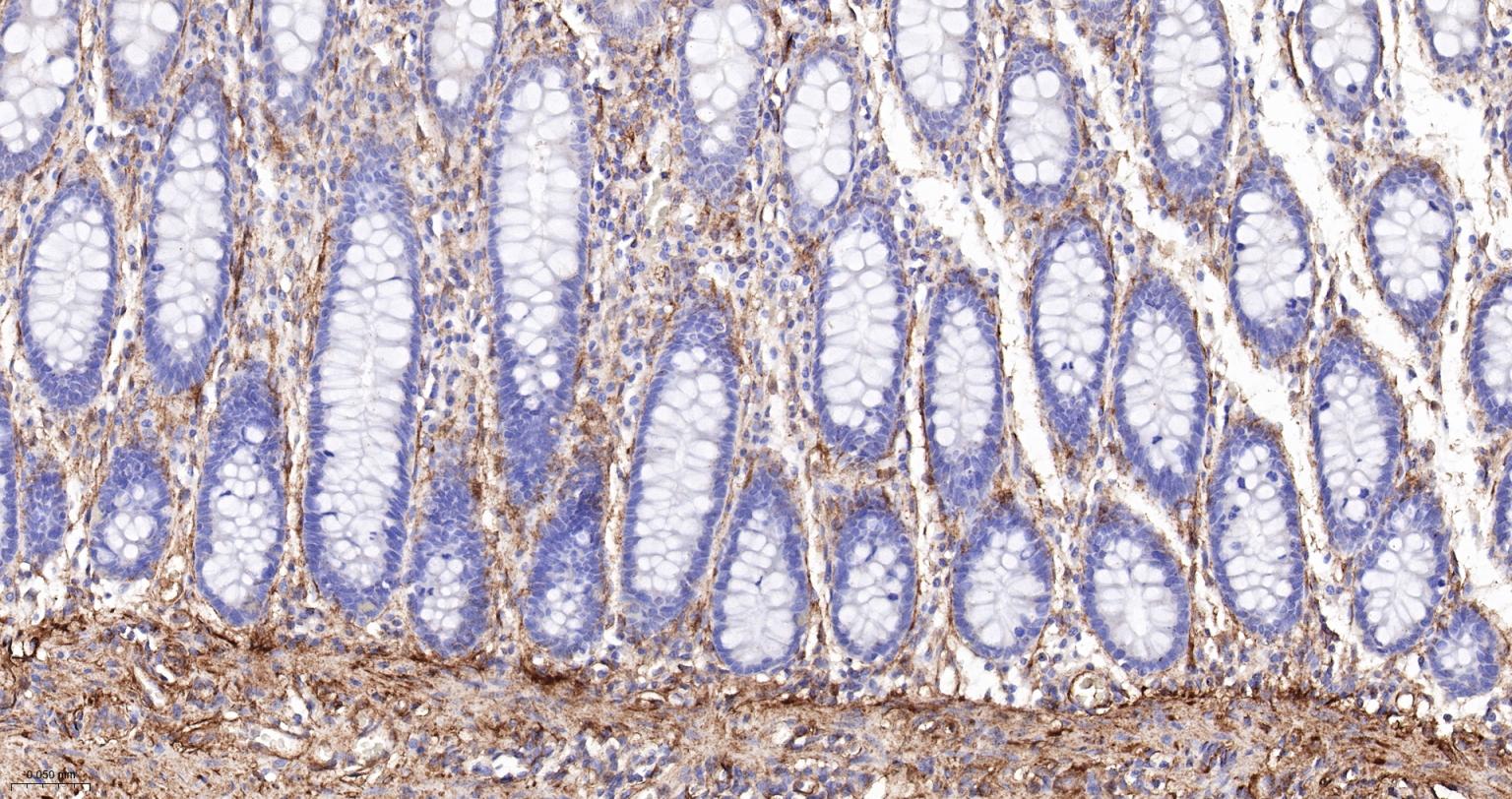 粘着斑蛋白（内参）重组兔单抗