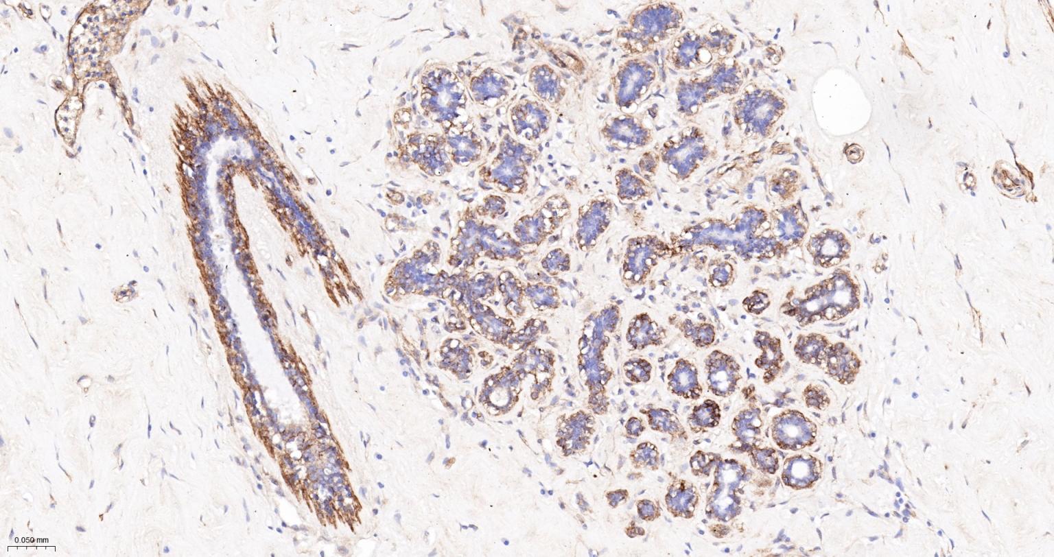 粘着斑蛋白（内参）重组兔单抗