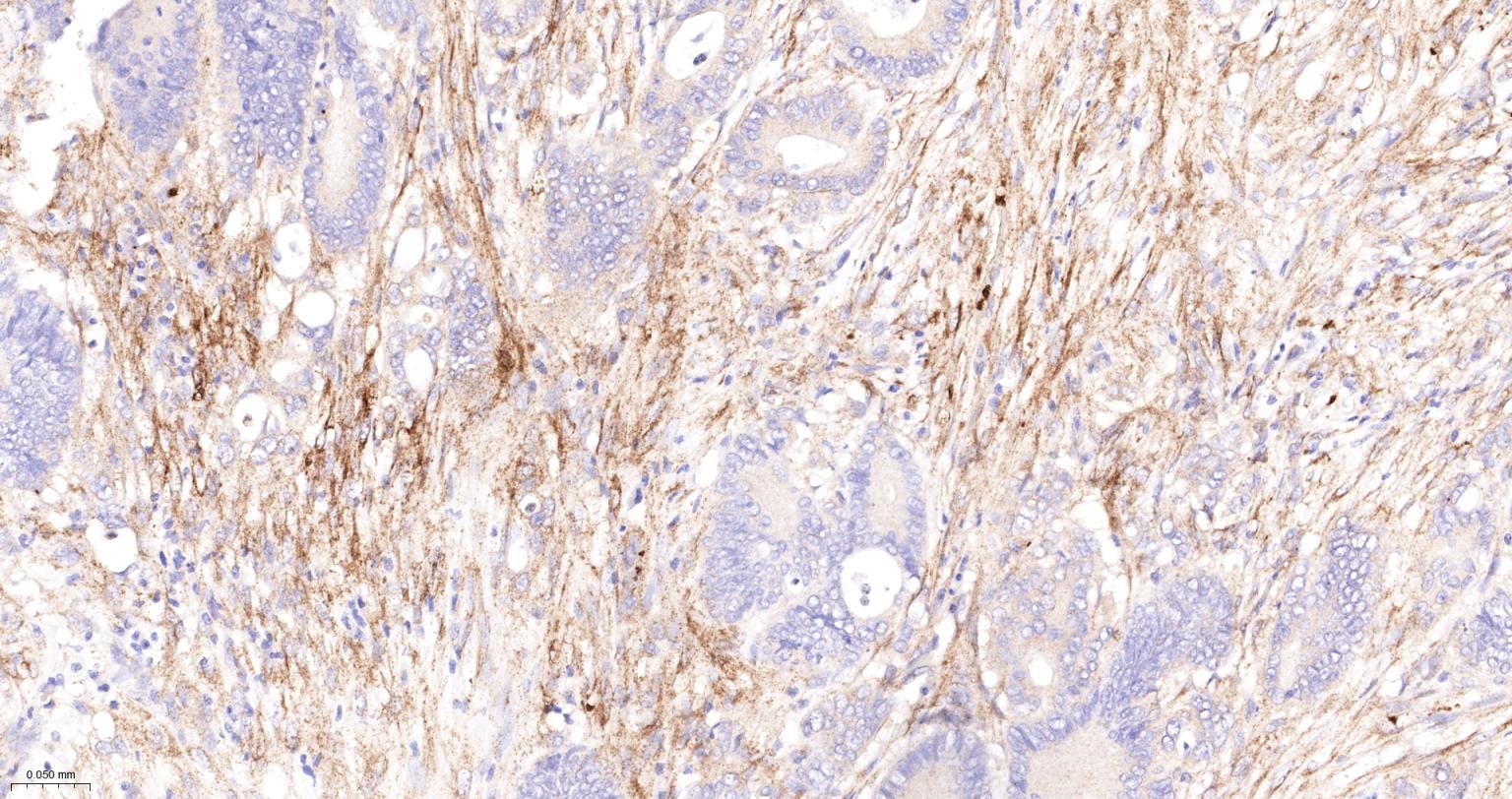 粘着斑蛋白（内参）重组兔单抗