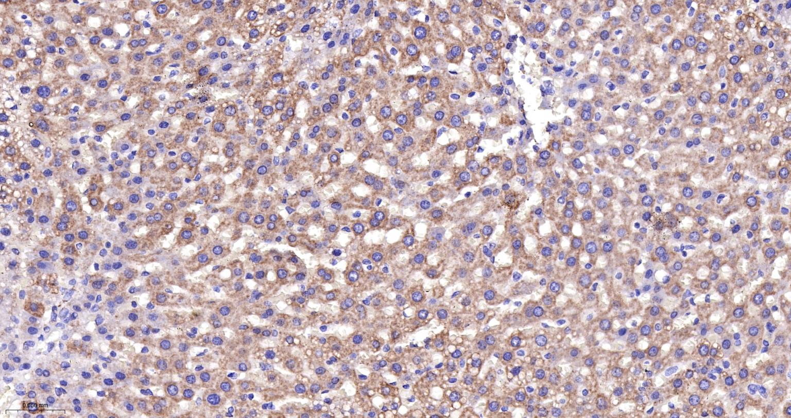 线粒体辅酶细胞色素C还原酶核心蛋白2重组兔单抗