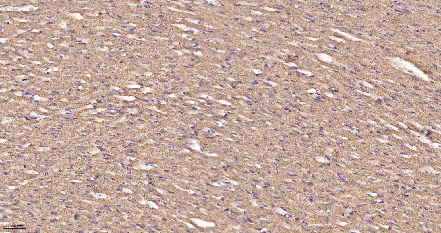 线粒体辅酶细胞色素C还原酶核心蛋白2重组兔单抗