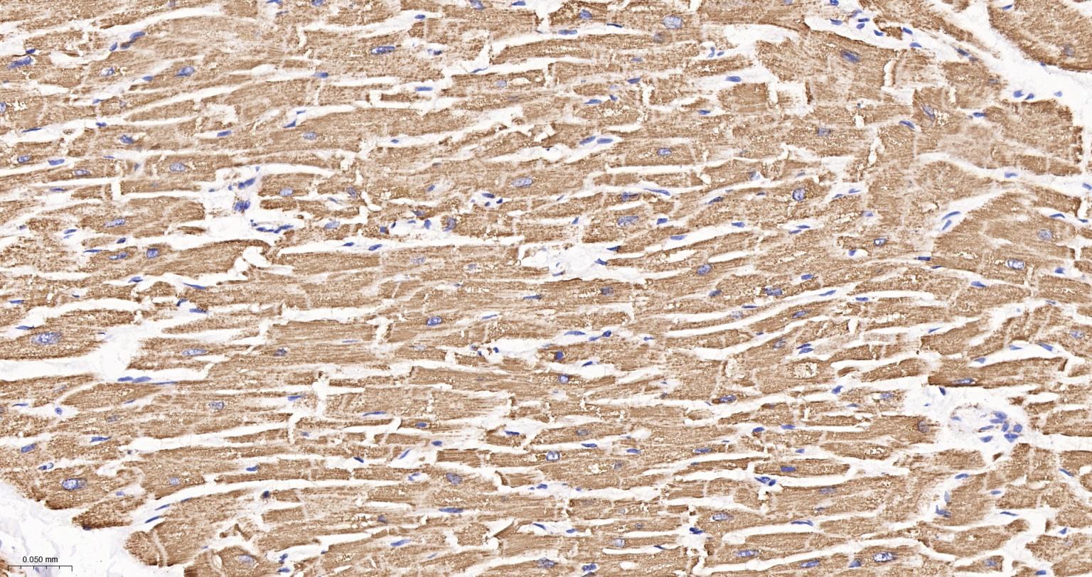 线粒体辅酶细胞色素C还原酶核心蛋白2重组兔单抗