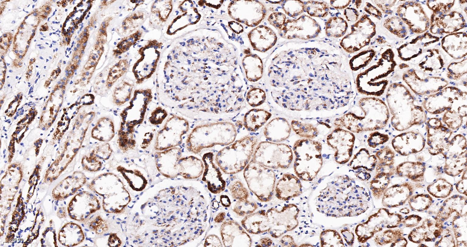 线粒体辅酶细胞色素C还原酶核心蛋白2重组兔单抗