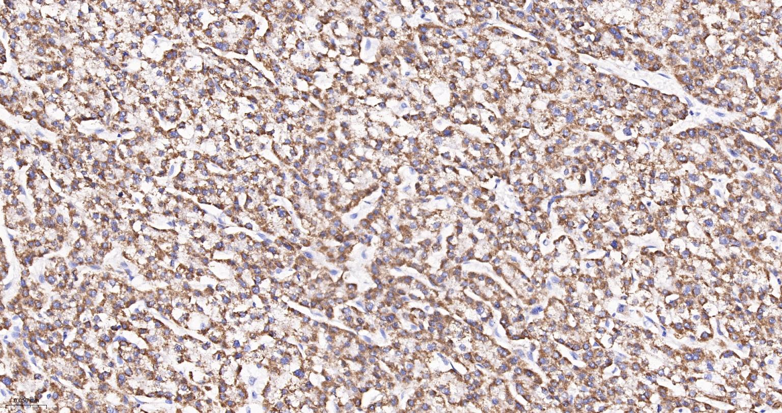 线粒体辅酶细胞色素C还原酶核心蛋白2重组兔单抗