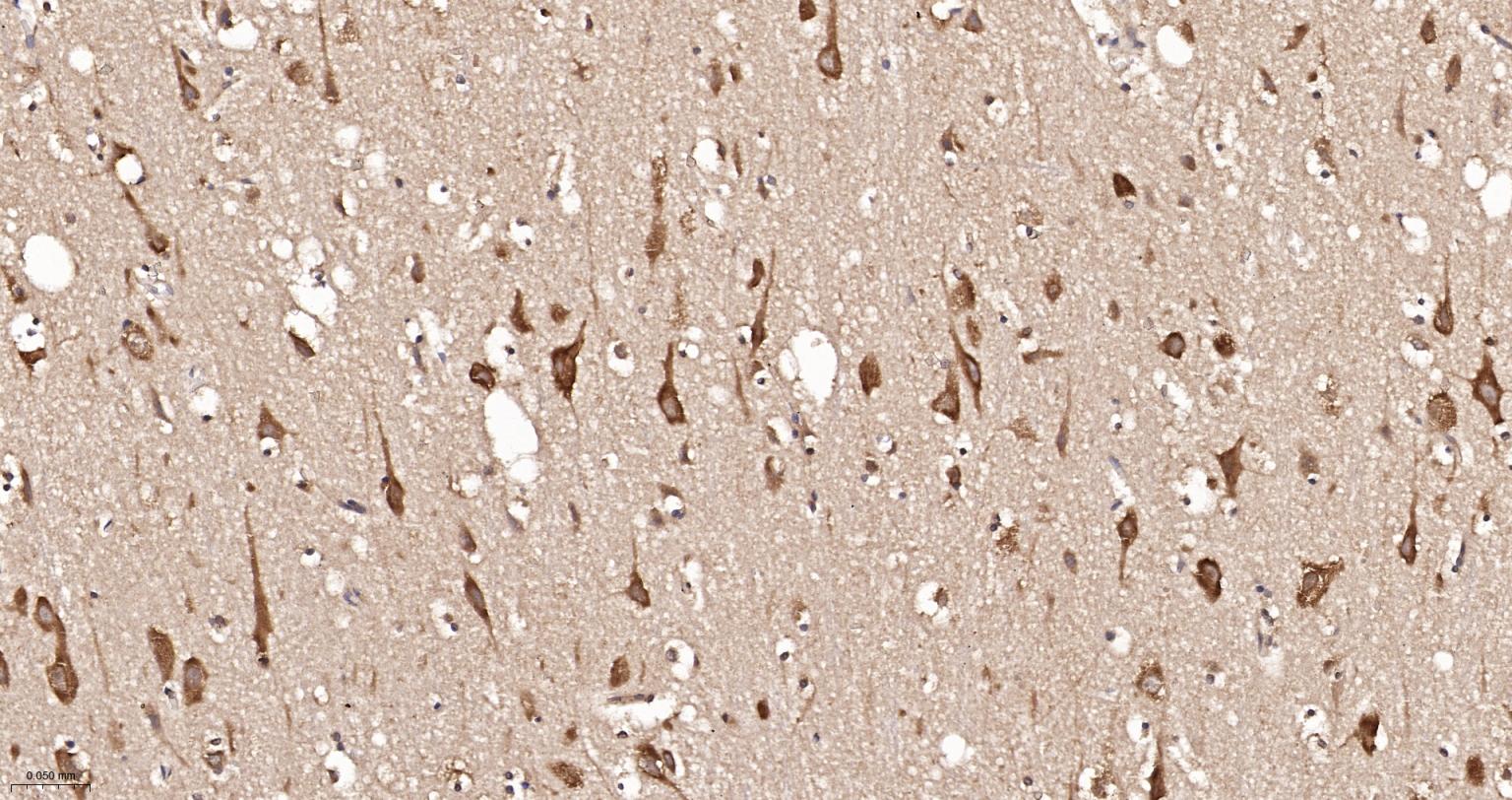 GADD153重组兔单抗