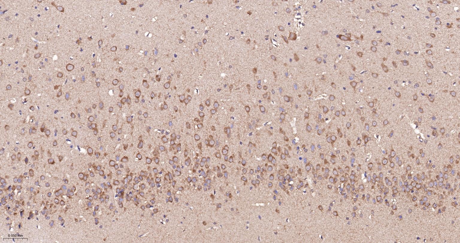 GADD153重组兔单抗