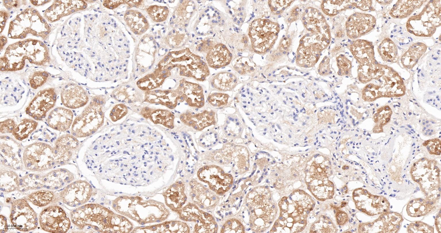 苯丙氨酸羟化酶4重组兔单抗