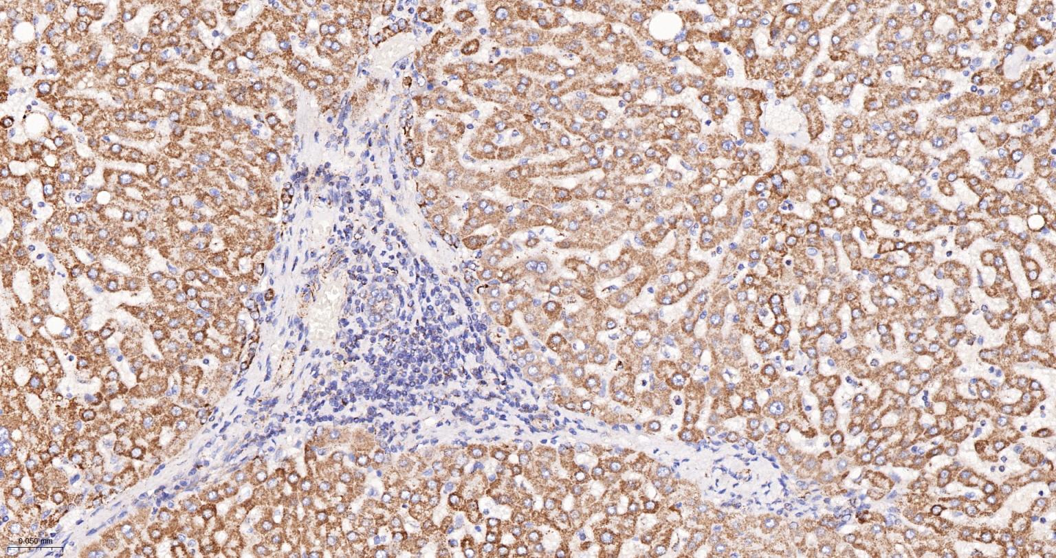 线粒体辅酶细胞色素C还原酶核心蛋白2重组兔单抗