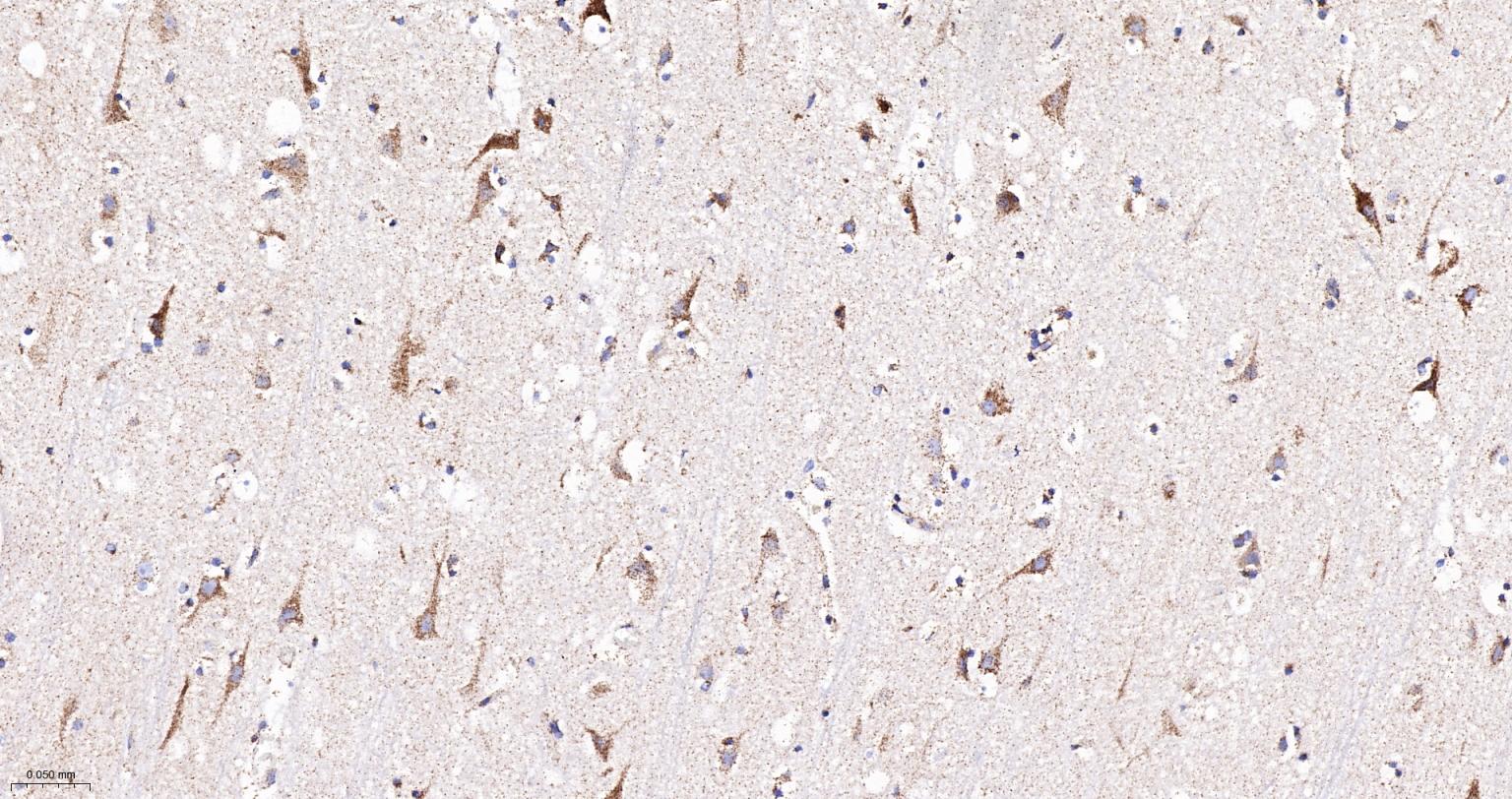 线粒体辅酶细胞色素C还原酶核心蛋白2重组兔单抗