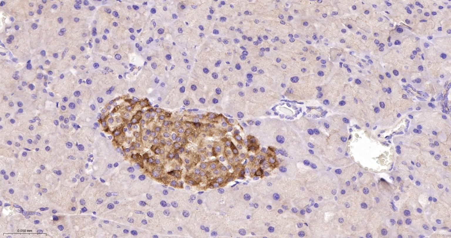 肌球蛋白1B重组兔单抗