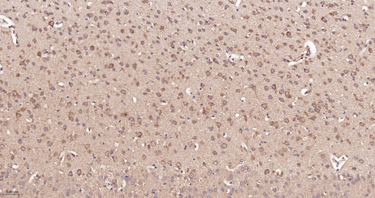 GADD153重组兔单抗