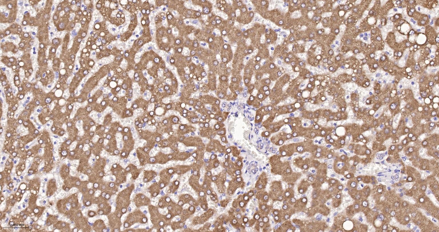 微粒体谷胱甘肽S转移酶1重组兔单抗