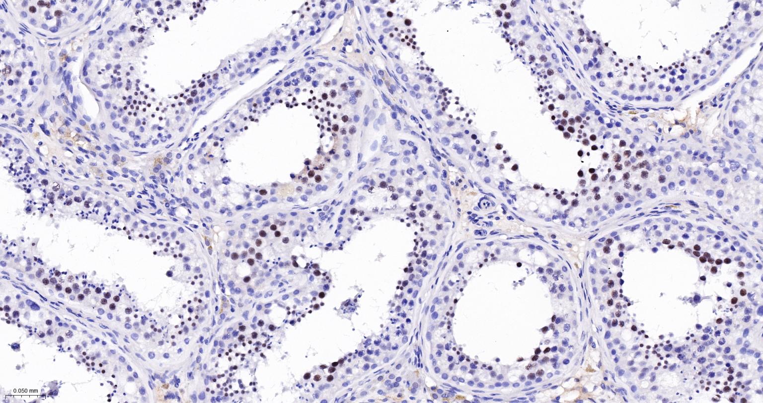 DNA连接酶4重组兔单抗
