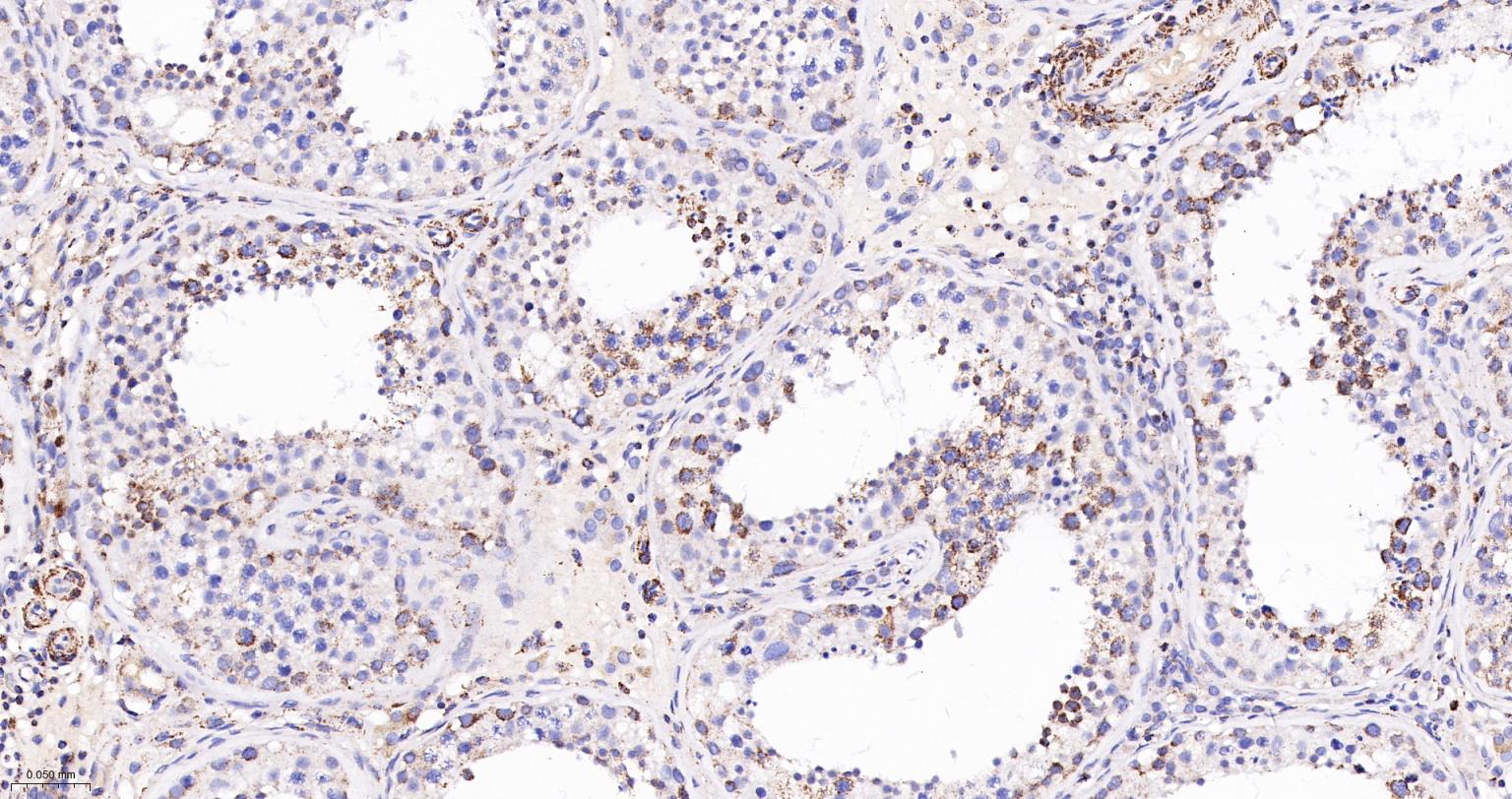 线粒体辅酶细胞色素C还原酶核心蛋白2重组兔单抗