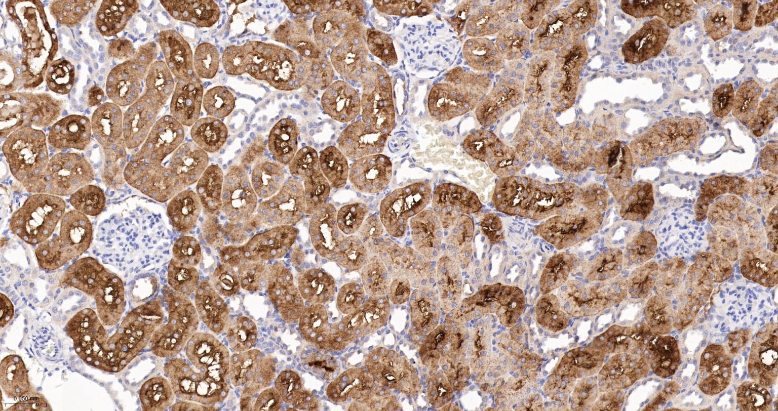苯丙氨酸羟化酶4重组兔单抗