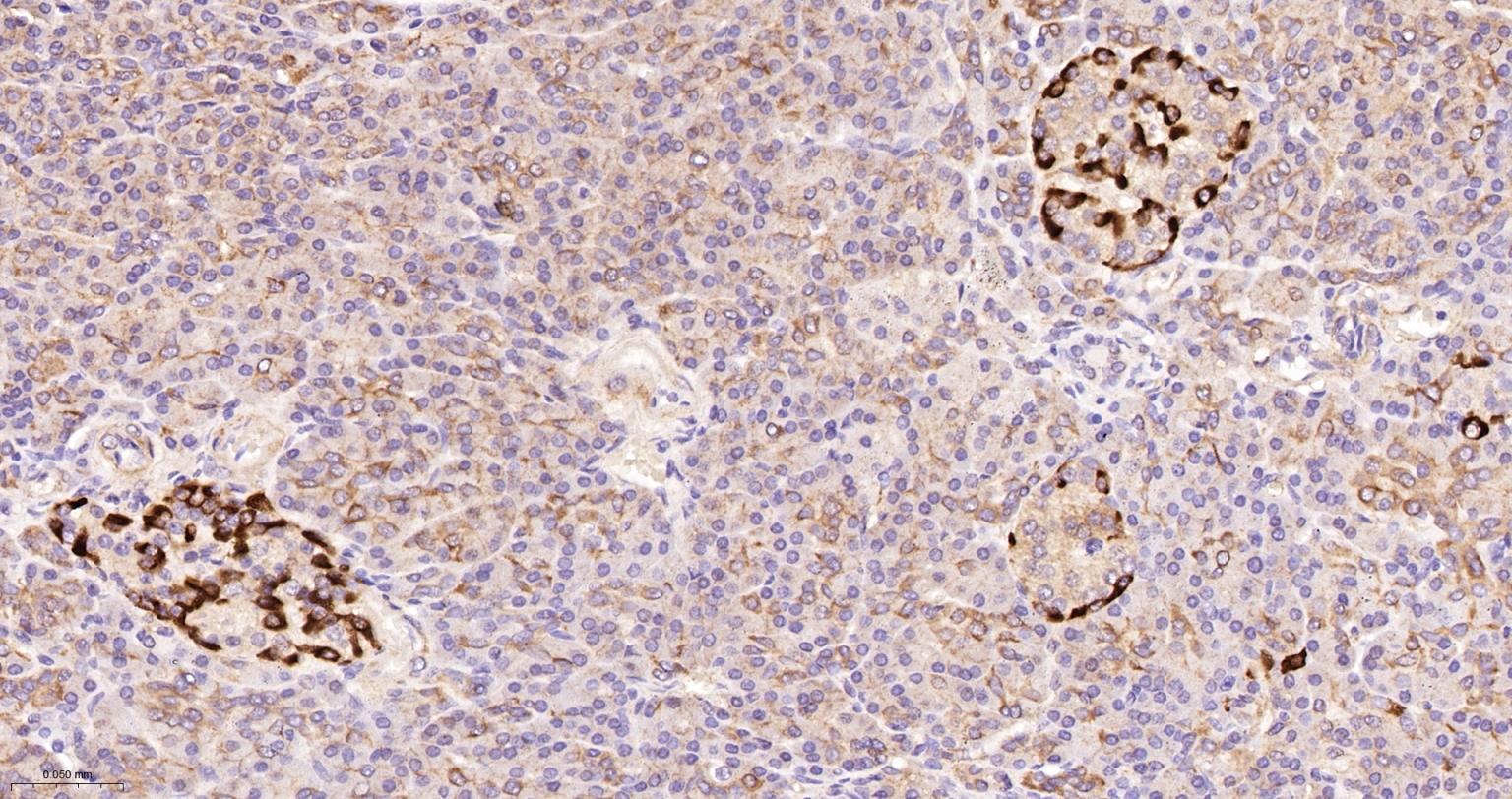 肌球蛋白1B重组兔单抗