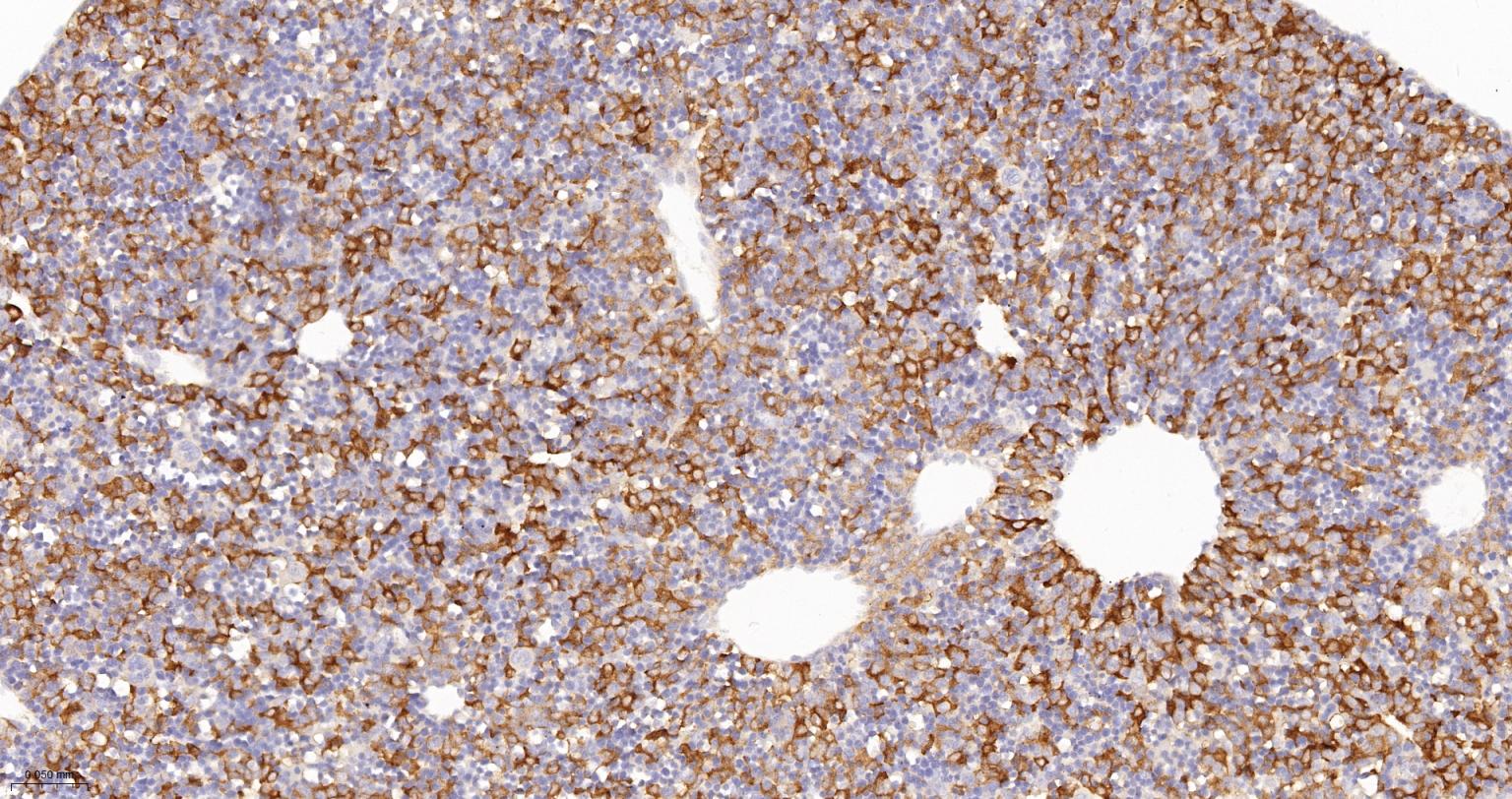 苯丙氨酸羟化酶4重组兔单抗