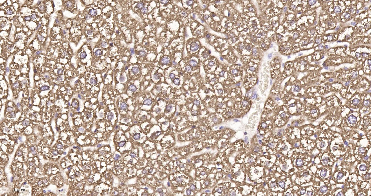 微粒体谷胱甘肽S转移酶1重组兔单抗