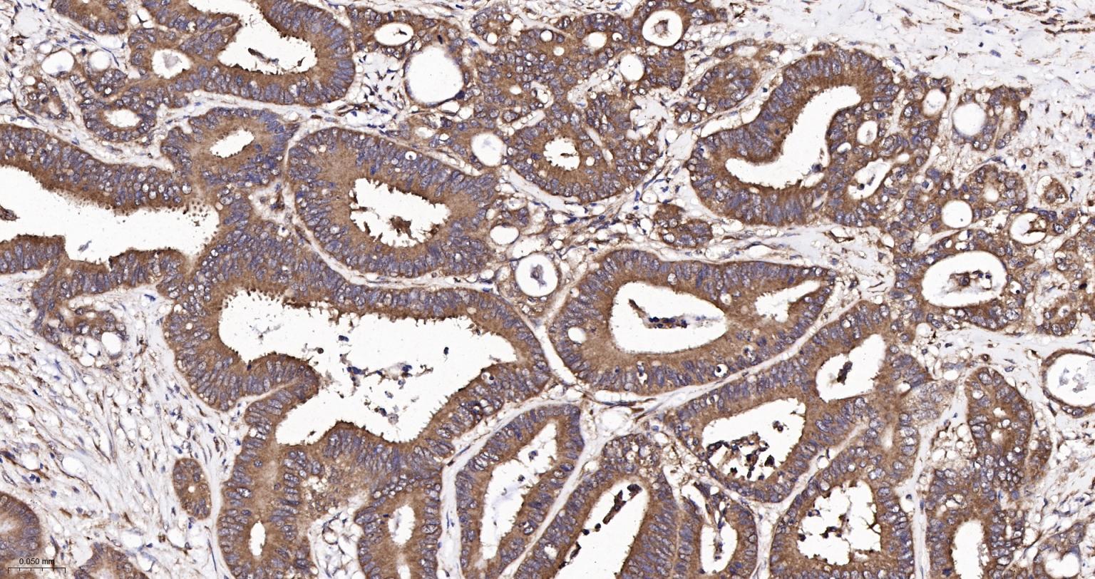 GADD153重组兔单抗