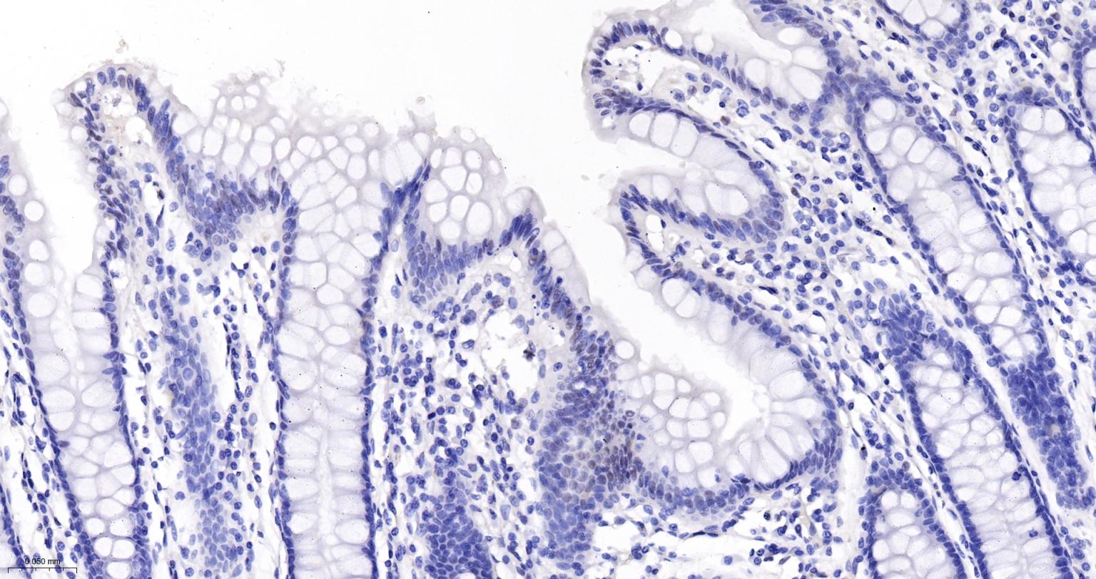 DNA连接酶4重组兔单抗