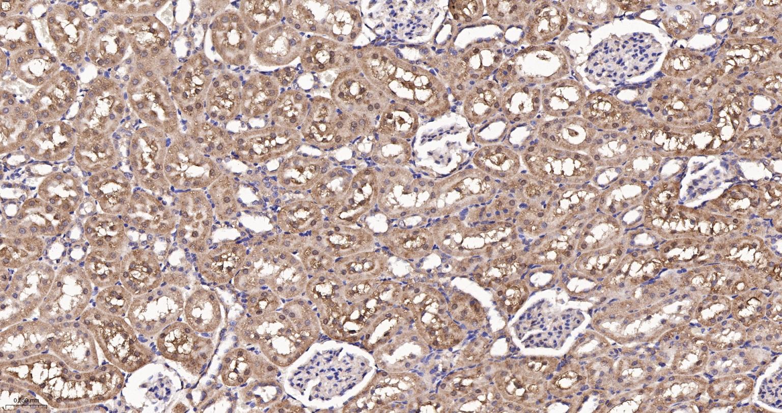 GADD153重组兔单抗