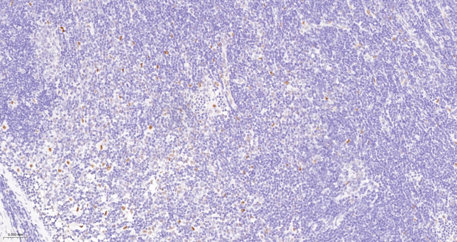 DNA连接酶4重组兔单抗