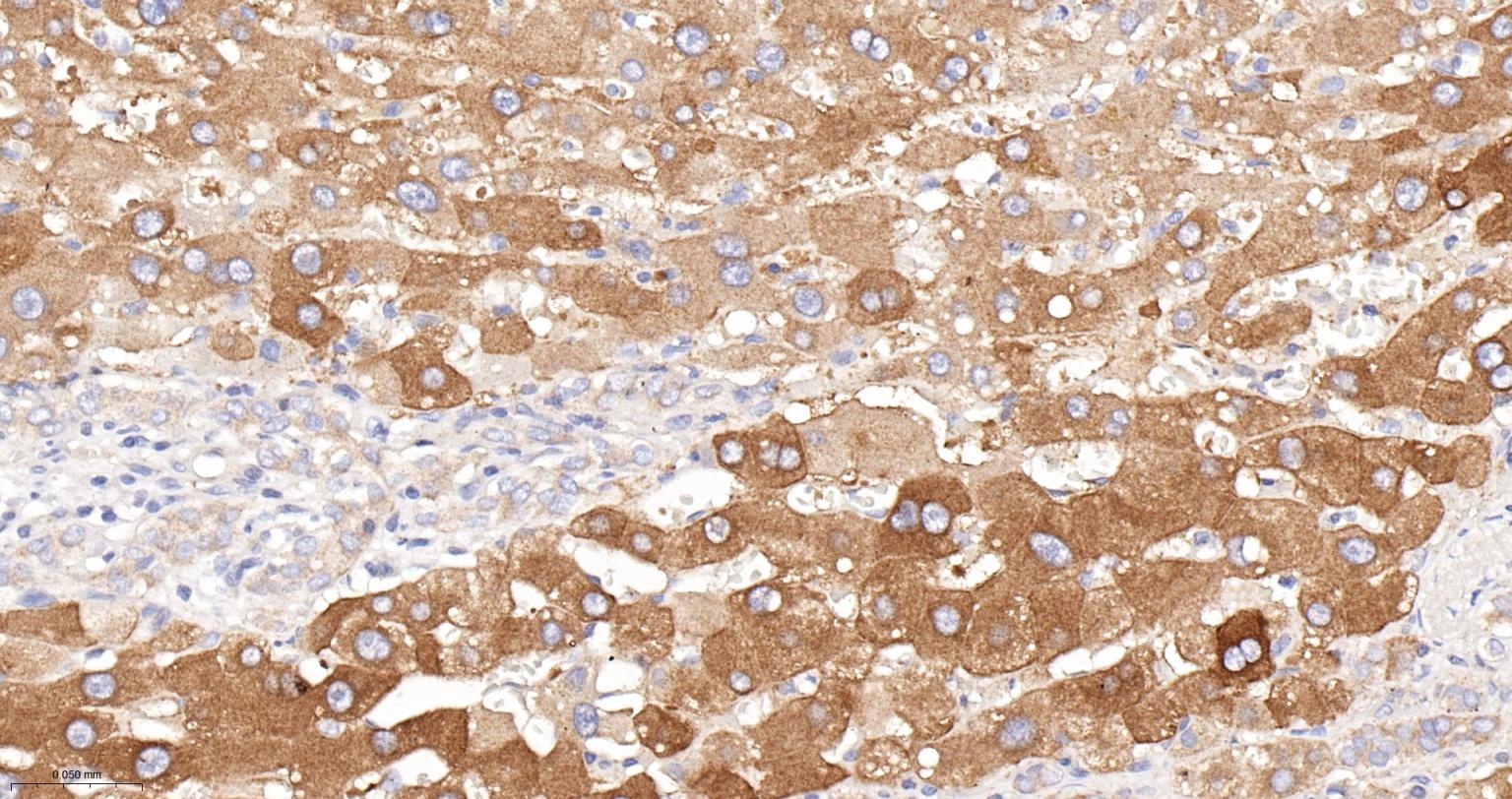 苯丙氨酸羟化酶4重组兔单抗