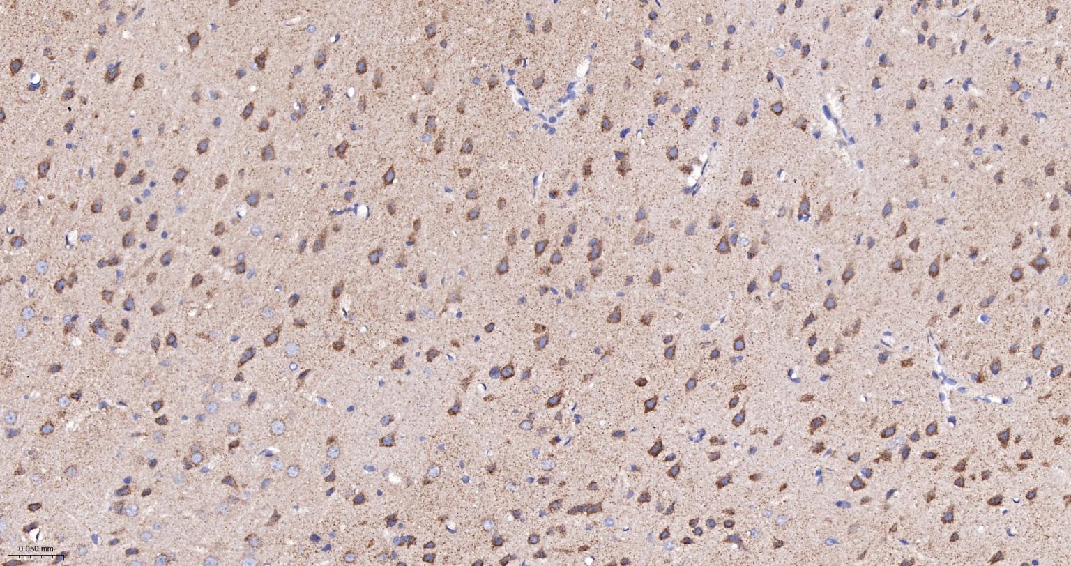 线粒体辅酶细胞色素C还原酶核心蛋白2重组兔单抗