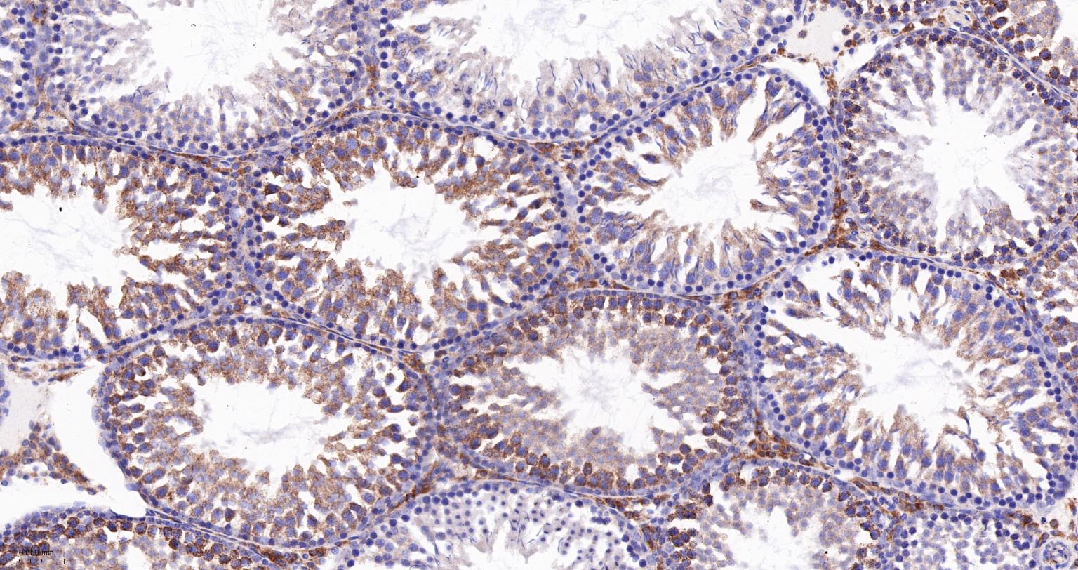 线粒体辅酶细胞色素C还原酶核心蛋白2重组兔单抗