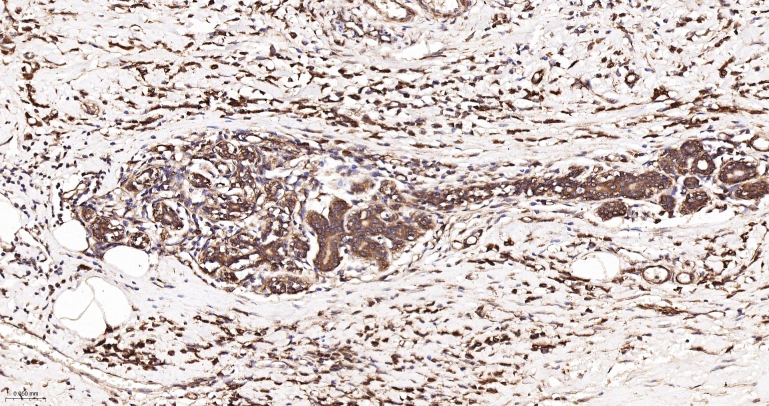 GADD153重组兔单抗