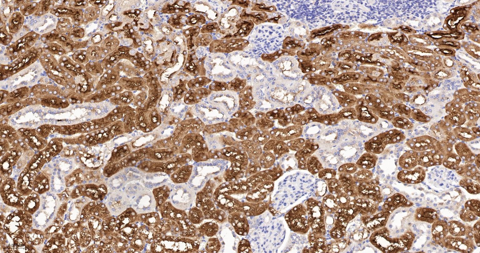 苯丙氨酸羟化酶4重组兔单抗
