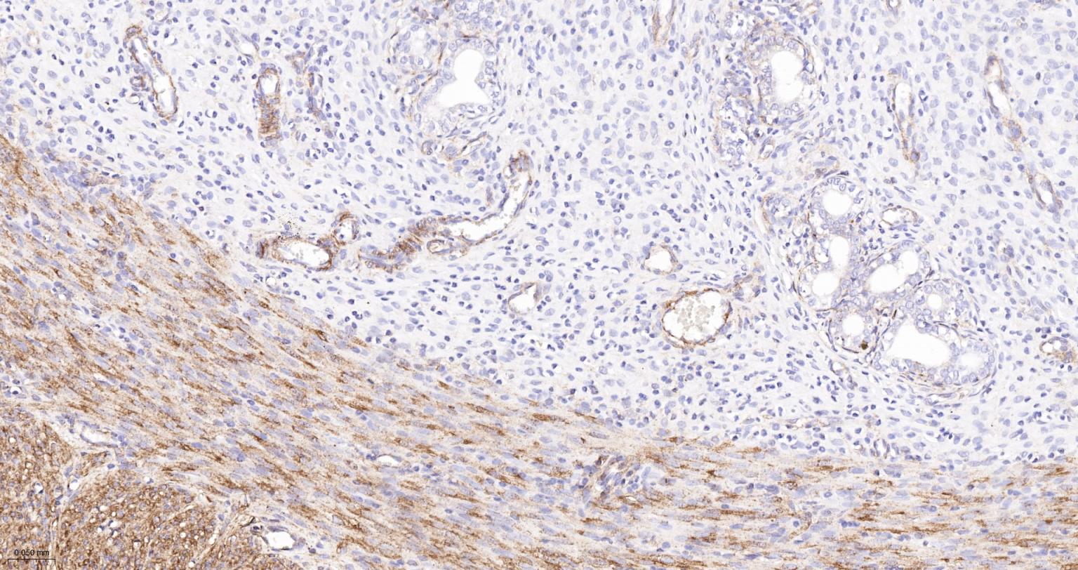 粘着斑蛋白（内参）重组兔单抗