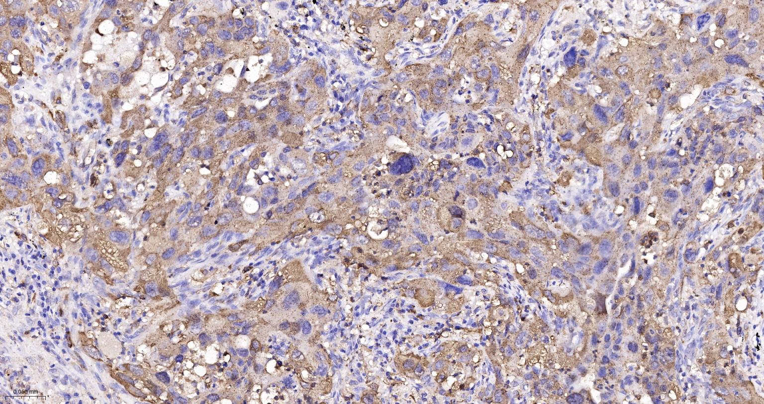 白血病相关蛋白18/癌蛋白18重组兔单抗