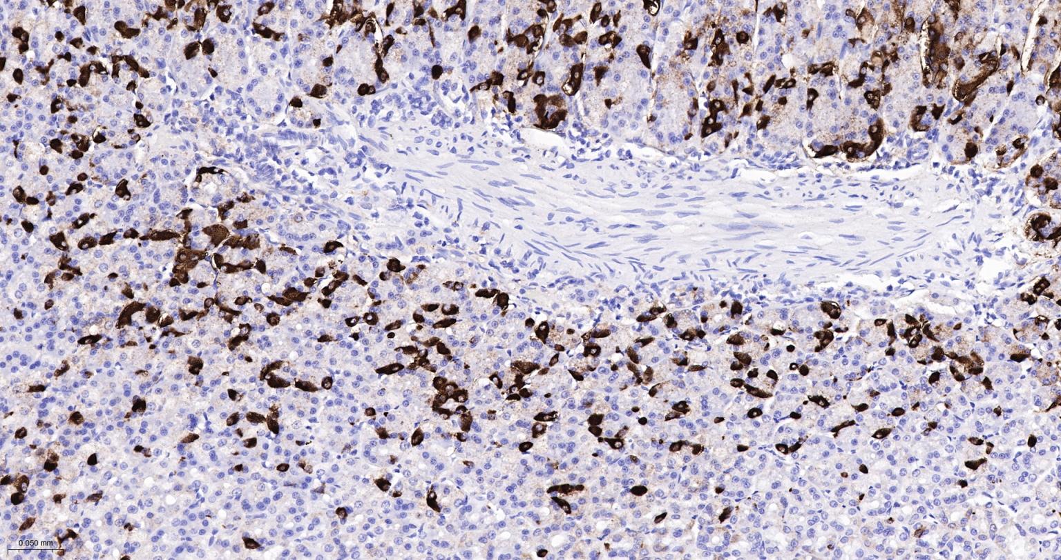 丝氨酸/苏氨酸蛋白激酶DCAMKL1重组兔单抗