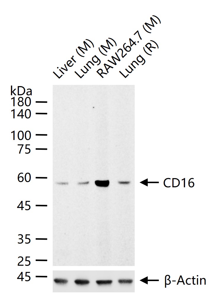 CD16 Rabbit pAb (一抗) - WB | Bioss