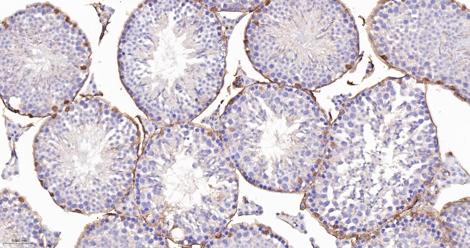 粘着斑蛋白（内参）重组兔单抗