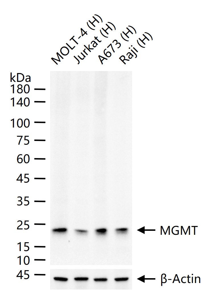 O6甲基鸟嘌呤DNA甲基转移酶重组兔单抗