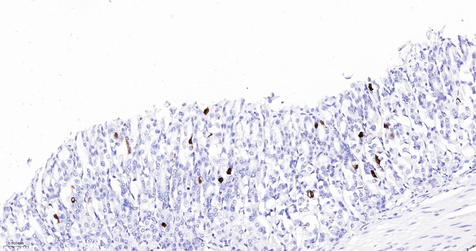 丝氨酸/苏氨酸蛋白激酶DCAMKL1重组兔单抗