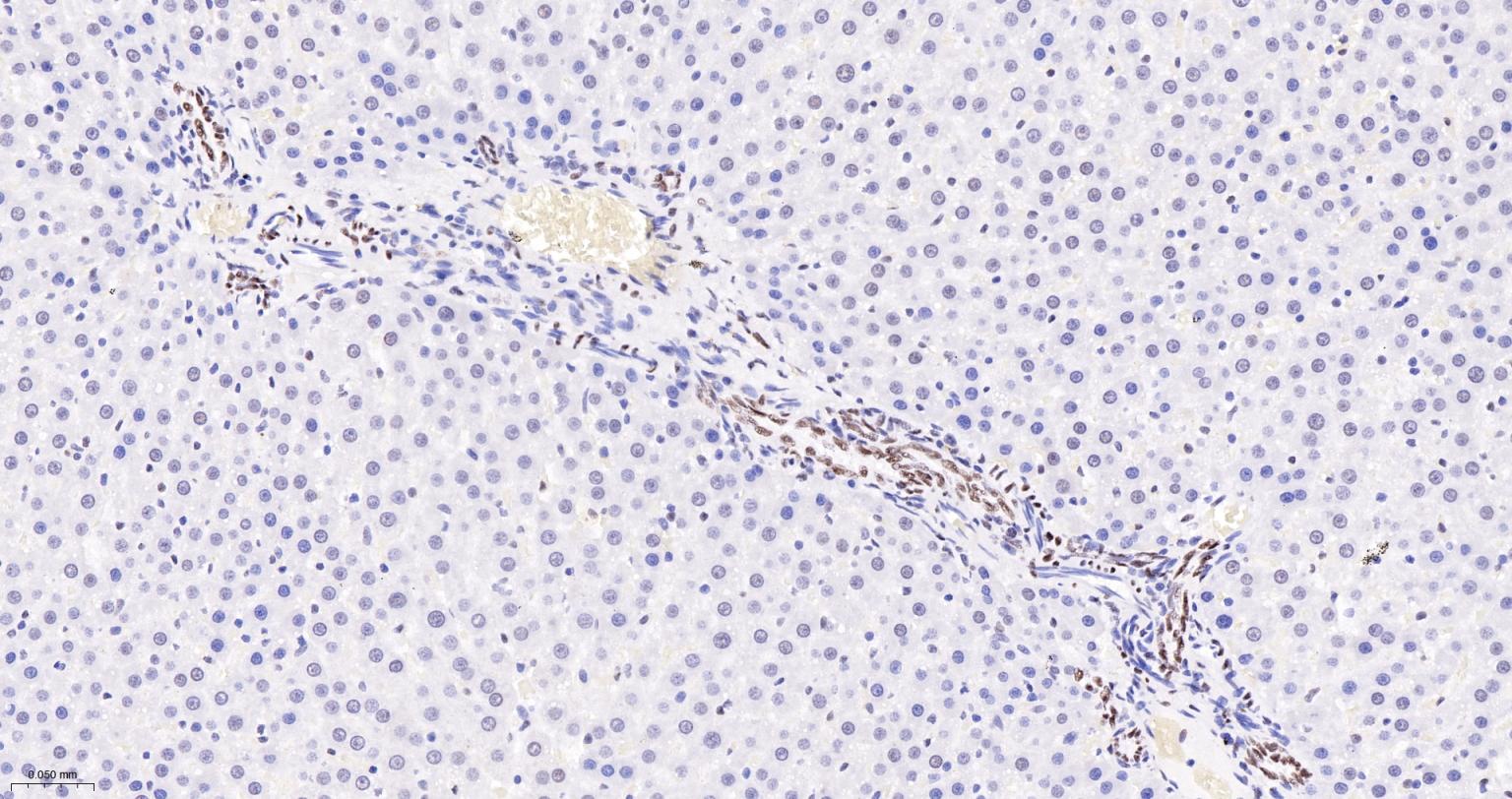 核呼吸因子-1重组兔单抗-bsm-54140R