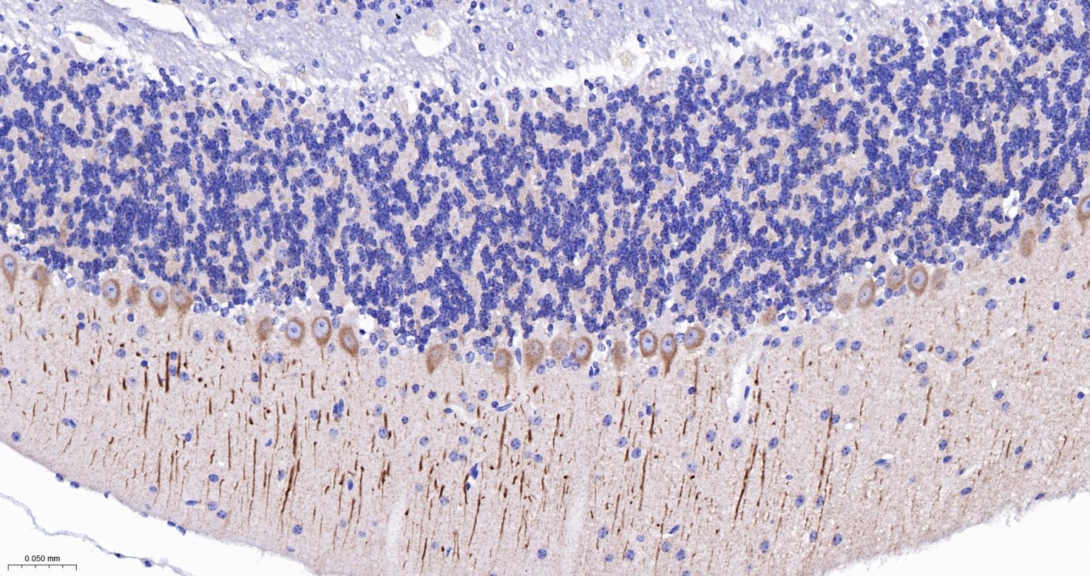 丝氨酸/苏氨酸蛋白激酶DCAMKL1重组兔单抗
