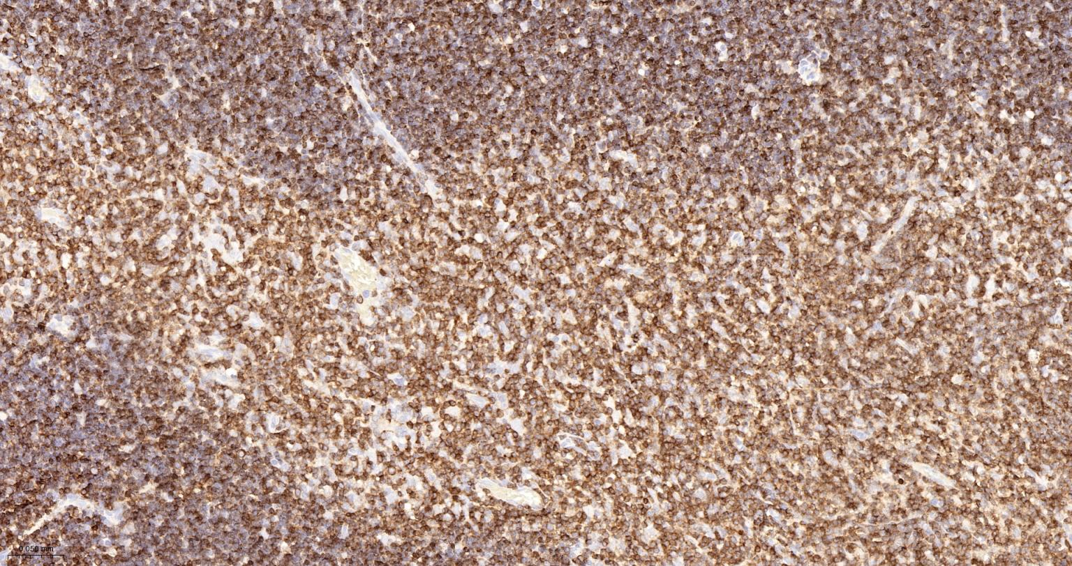 CD3/CD3-ε重组兔单抗