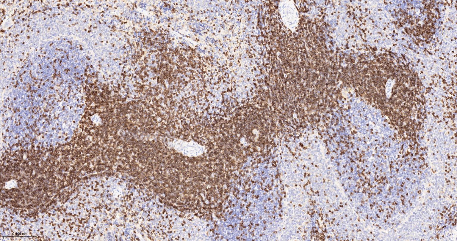 CD3/CD3-ε重组兔单抗