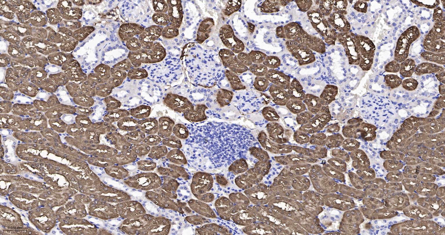 果糖1，6-二磷酸酯酶重组兔单抗
