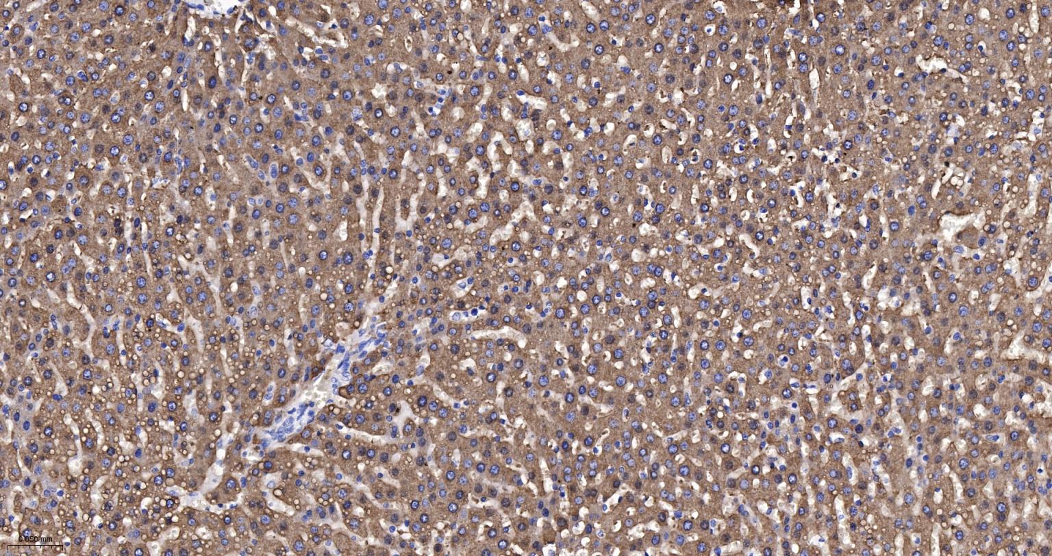 细胞色素P450 2D6重组兔单抗-bsm-61641R