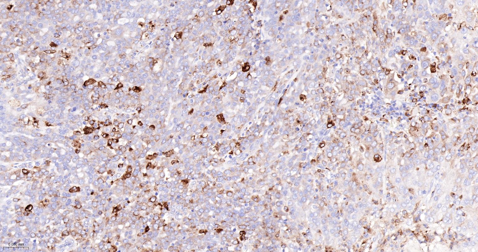 组织蛋白酶B重组兔单抗